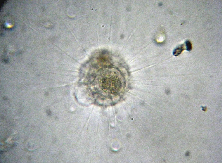 Esiste l''Actinophrys vesiculata?